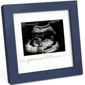 Baby Sonogram Picture Frame